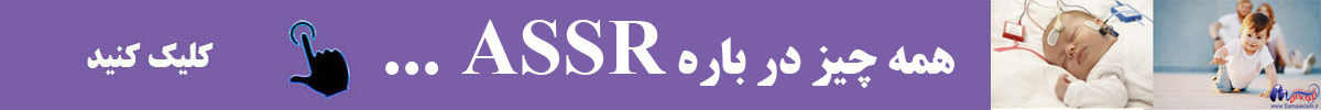 همه چیز در باره ASSR .jpg