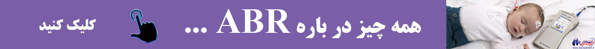 همه چیز در باره ABR