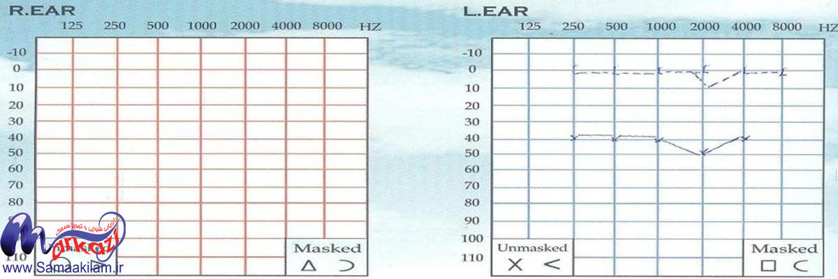 ادیو گرام